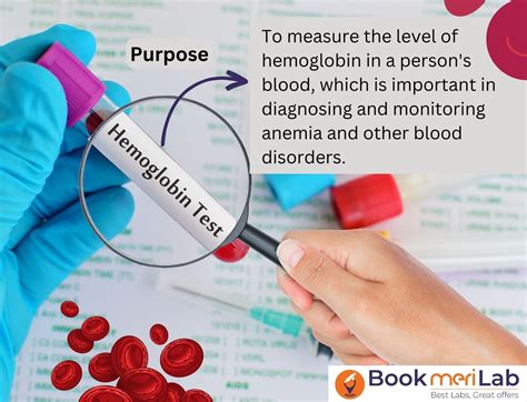 Hemoglobin (Hb) Test: Get Price, Purpose, Risks & Result [2024]