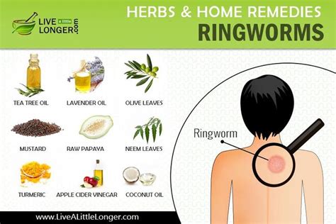 Pin by Kristy Turner on Hacks & Remedies i had no idea about. ※﹋o﹋※ in 2020 | Ringworm remedies ...