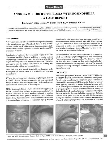 (PDF) Angiolymphoid hyperplasia with eosinophilia - A case report