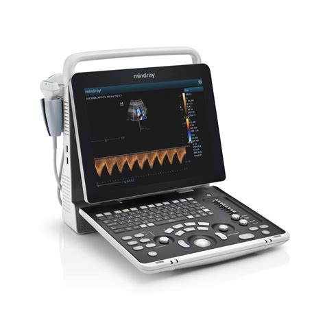 Mindray Z60 3D/ 4D Ultrasound Machine at Rs 1050000/piece | Mindray ...