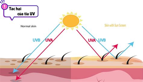 Tia UV là gì? Những thông tin bạn cần biết về tia UV