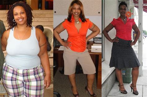 Gastric Sleeve success patient. http://certifiedbariatricsurgeons.com/contact Weight Loss Before ...