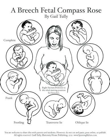 Belly Mapping Breech - How to tell if baby is breech - Spinning Babies ...