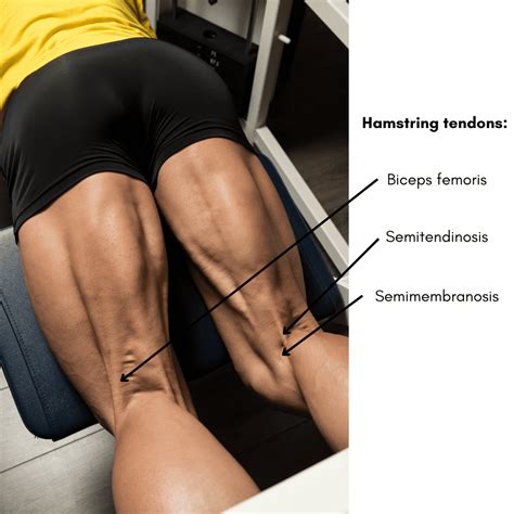 Distal (Low) Hamstring Tendonitis: Symptoms, Causes & Exercises