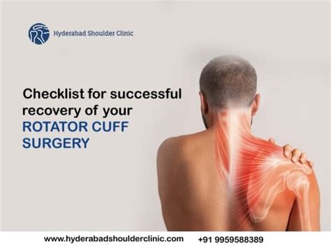 Checklist for successful recovery of your rotator cuff surgery ...