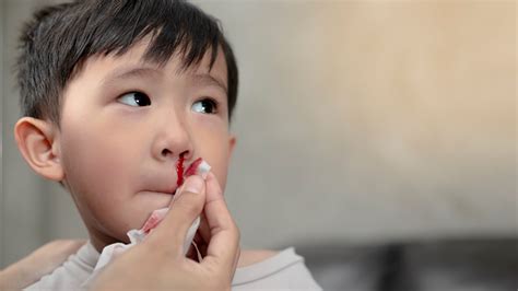 What causes nosebleeds in children?