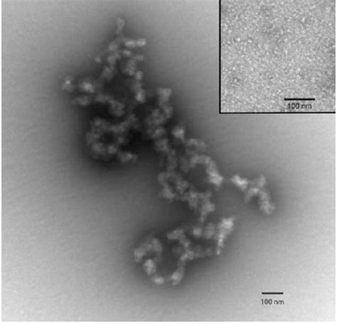 Transmission electron micrograph of uranyl-acetate stained ultraviolet... | Download Scientific ...