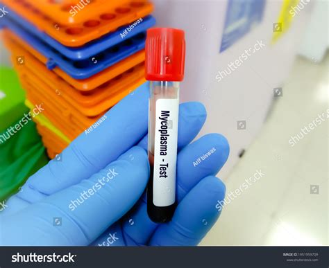 118 Mycoplasma Test Images, Stock Photos & Vectors | Shutterstock