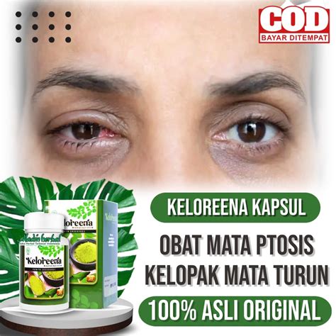 Jual Obat Mata Ptosis, Kelopak Mata Turun Sebelah, Mata Merah, Kelopak ...