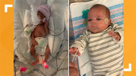 'Miracle baby' born at 22 weeks breaks hospital record | wwltv.com