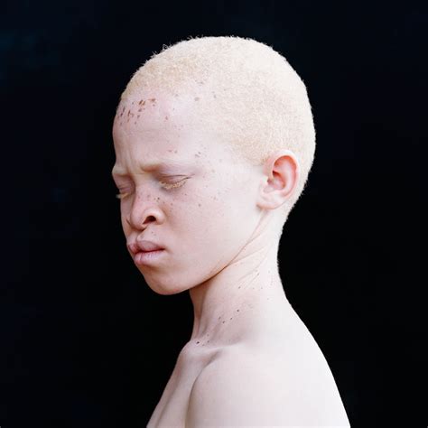 15 pessoas albinas que te vão hipnotizar com sua beleza de outro mundo