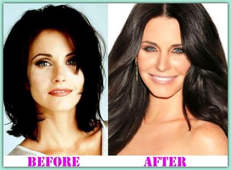 Surgery Plastic Before After: Courteney Cox Plastic Surgery – How Not ...