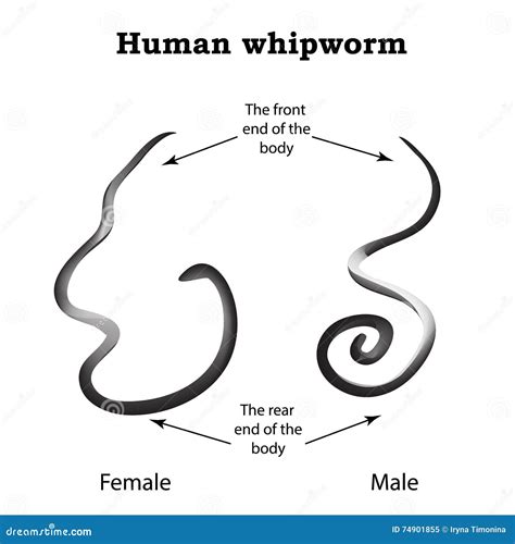 Whipworm. Structure Whipworm Females. the Structure of the Male Whipworm. Infographics Stock ...