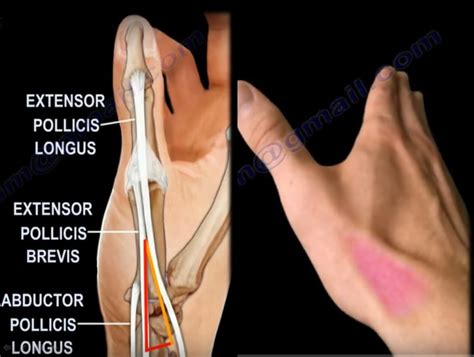 Anatomy and Contents of the Anatomical Snuff Box — OrthopaedicPrinciples.com