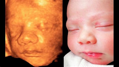 Get Ready to Melt: Adorable 4D Baby Ultrasound Clips Will Melt Your Heart - AtoAllinks