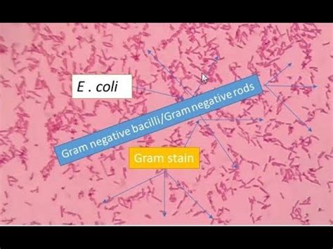 GRAM POSITIVE VS GRAM NEGATIVE BACTERIA | escherichia coli gram stain – Webgiasi.vn – Siêu thị ...