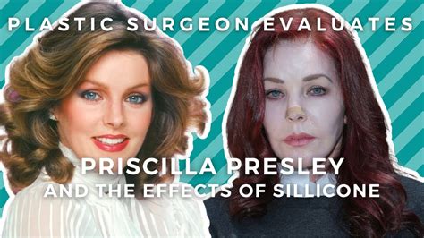 Priscilla Presley Plastic Surgery: Illegal Silicone + Fake Doctors ...