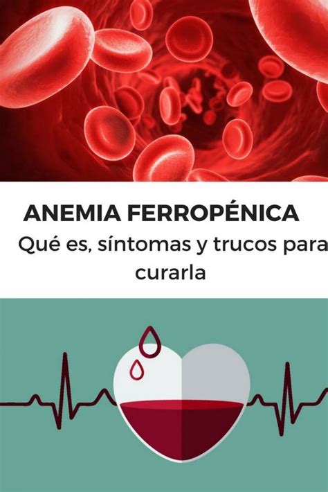 ANEMIA FERROPÉNICA | Qué es, síntomas y trucos para curarla