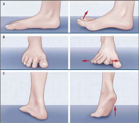 Home Remedies to Treat, Exercise, and Prevent Bunions | WalkJogRun