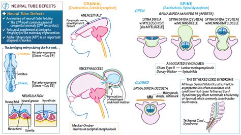 Clinical Pathology: Neural Tube Defects (eg, Spina Bifida) | ditki medical & biological sciences