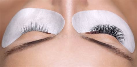 Eyelash Removal Procedure Close Up. Stock Image - Image of cosmetic ...