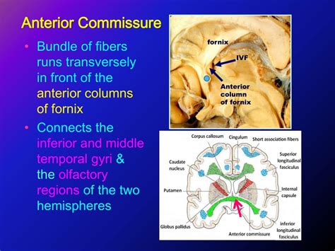 PPT - White Matter (Medulla) PowerPoint Presentation, free download ...