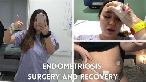 ENDOMETRIOSIS | SURGERY & RECOVERY VLOG | LAPAROSCOPY - YouTube