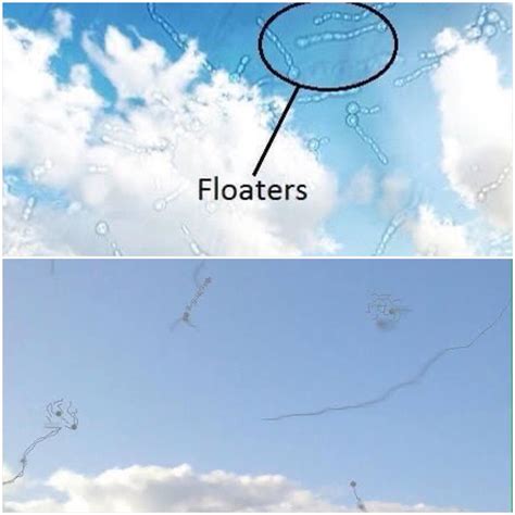 Who knows, what is the difference between this two types of floaters? I see them both and ...