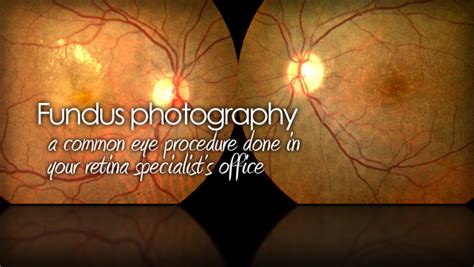 Fundus photography is used to photograph inside the eye