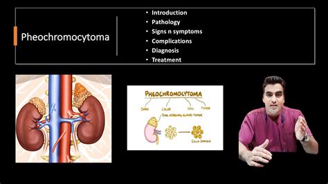 PHEOCHROMOCYTOMA-INTRODUCTION, ETIOLOGY, PATHOPHYSIOLOGY, SIGNS ...