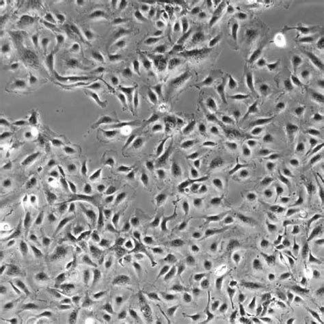 Endothelial Cell Culture Medium VascuLife EnGS