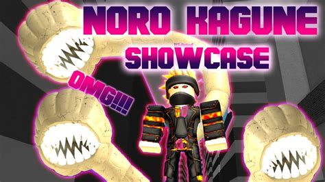 [Ro-Ghoul] - NORO SHOWCASE/REVIEW (Is it worth it?) | Doovi