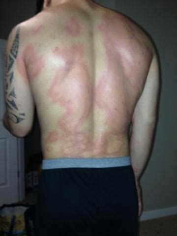 This is what happens when you're allergic to dust mites and tear out old carpet : WTF