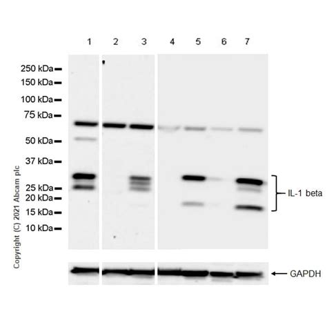 Recombinant Anti-IL-1 beta antibody [RM1009] (ab283818) | Abcam