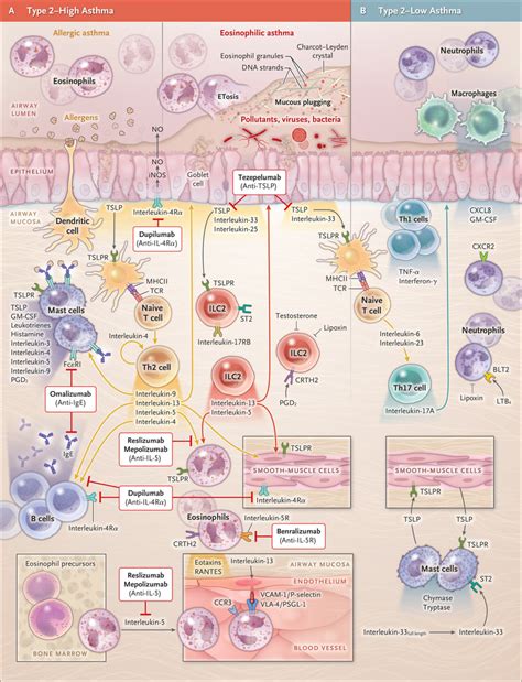 Biologic Therapies for Severe Asthma | NEJM