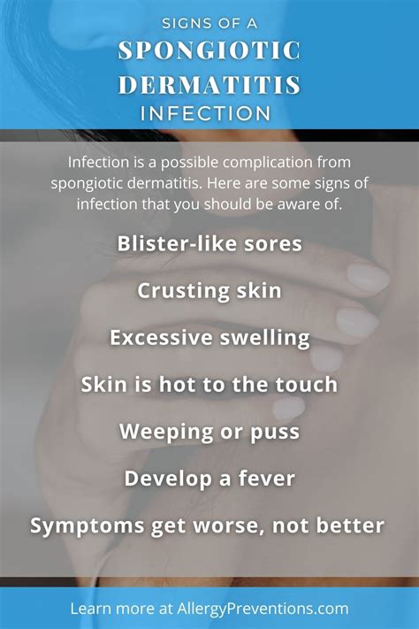 Spongiotic Dermatitis: Symptoms, Causes, Treatments