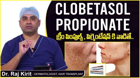 పింపుల్స్ , పిగ్మెంటేషన్| Steroid Cream Side Effects | Clobetasol Propionate Cream | Celestee ...