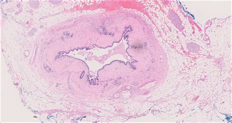 Bile duct – Normal Histology – NUS Pathweb :: NUS Pathweb