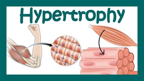 Hypertrophy | What is hypertrophy? | Mechanism of muscle hypertrophy | How does hypertrophy ...