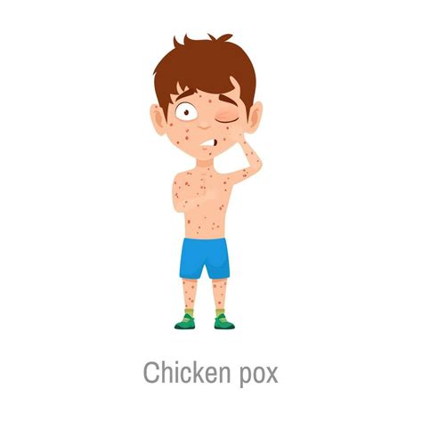 Chicken pox kid sickness, isolated vector sick boy 23842535 Vector Art at Vecteezy