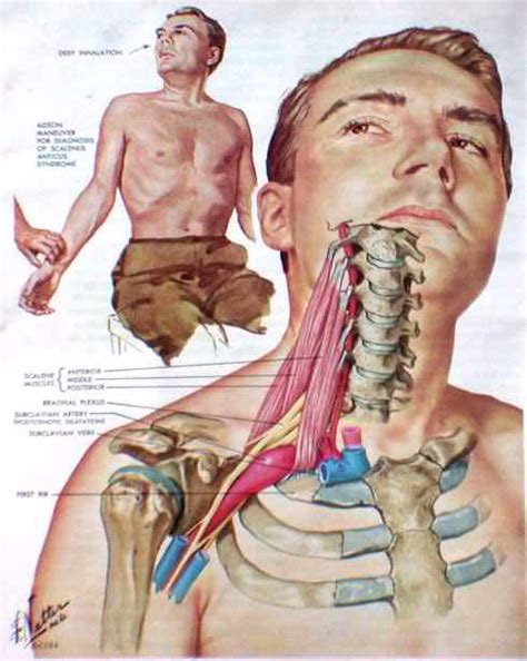 Postural orthostatic tachycardia syndrome (POTS) and its relation to craniovascular dysfunction ...