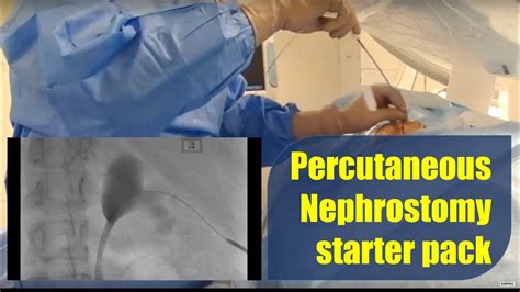 Percutaneous Nephrostomy procedure and technique: starter pack - YouTube