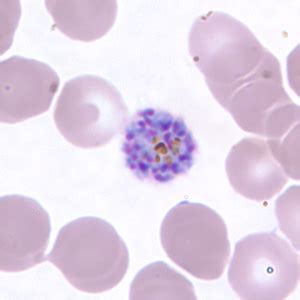 Plasmodium Vivax Images