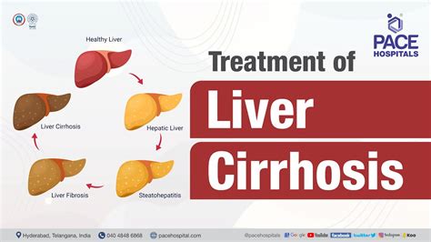 Treatment for Liver Cirrhosis | PACE Hospitals #Shortvideo #livercirrhosis - YouTube