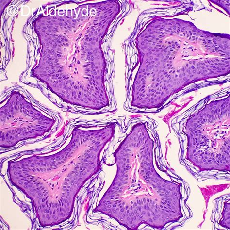 Acrochordon Histology