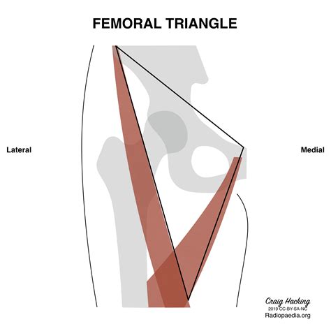 Radiopaedia - Drawing Boundaries of the femoral triangle - no labels | AnatomyTOOL