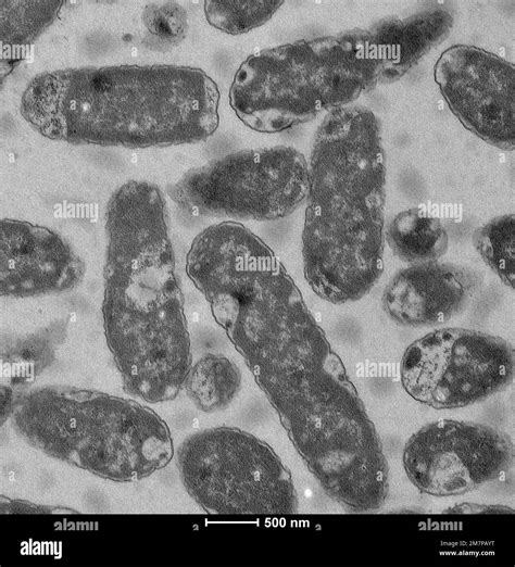 Escherichia coli (E.coli) under Transmission electron microscopy (TEM ...