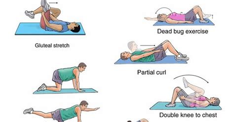 Spondylolysis and Spondylolisthesis | Physical Therapy Ideas | Pinterest | Spondylolisthesis ...