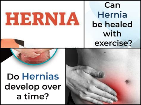 Hernia: Symptoms, Causes, Types, Risk & Treatment