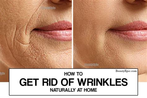 20 Effective Home Remedies To Get Rid of Wrinkles Naturally